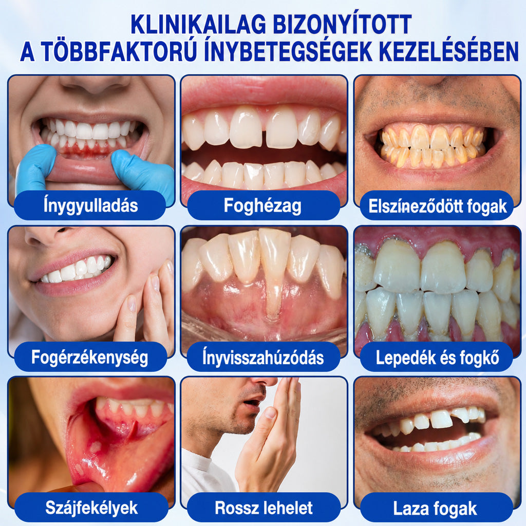 🇭🇺👨‍⚕️✅🦷 Trilumia® GumRevive – fejlett gél az íny és a fogágy ápolására