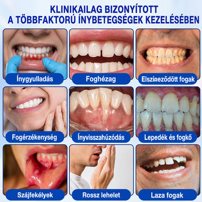 🇭🇺👨‍⚕️✅🦷 Trilumia® GumRevive – fejlett gél az íny és a fogágy ápolására