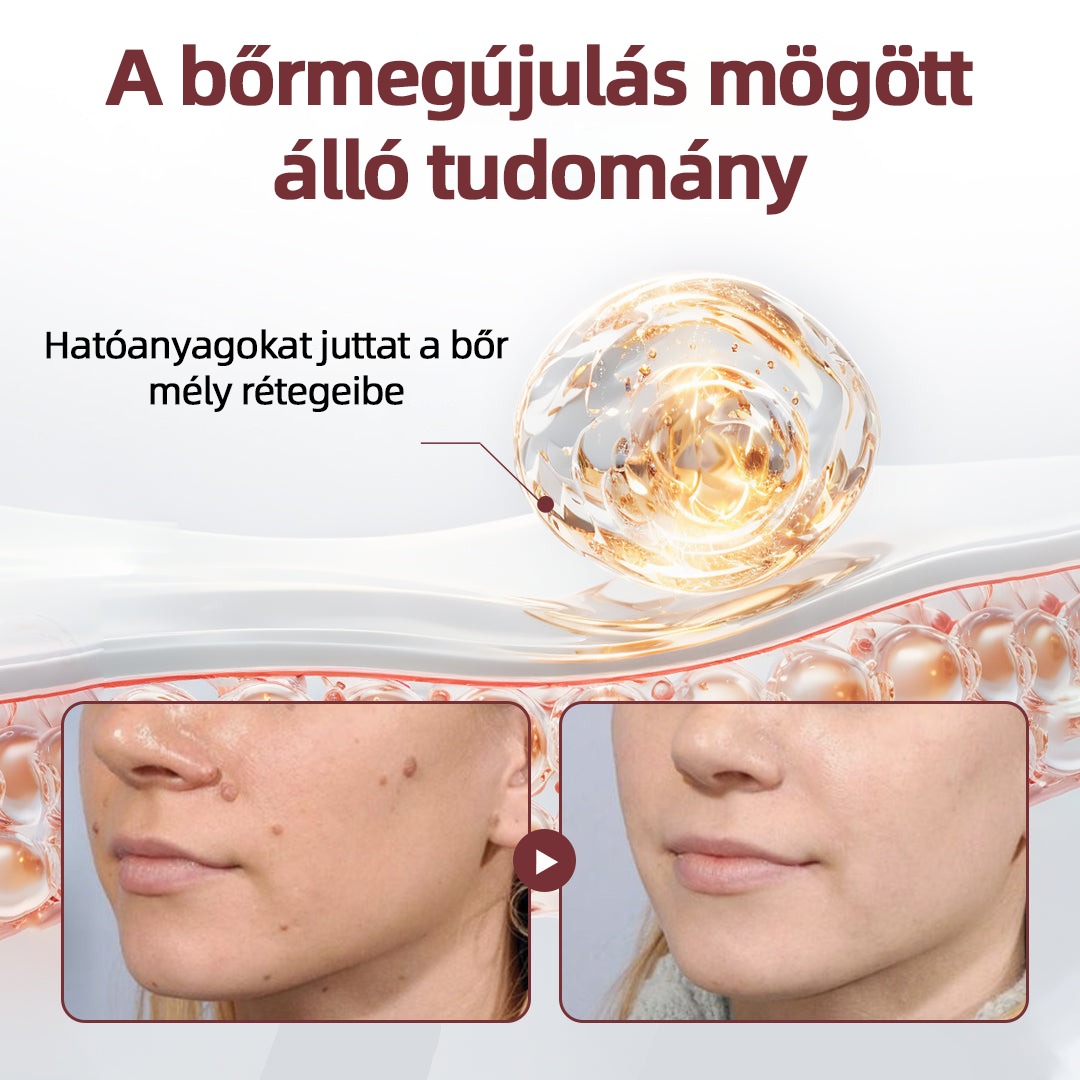 Thonesr® 👩‍⚕️KeraErase kettős hatású megújító krém