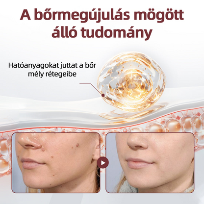 Thonesr® 👩‍⚕️KeraErase kettős hatású megújító krém