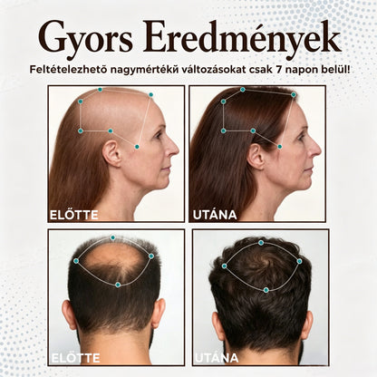 𝐋𝐞𝐠𝐧é𝐩𝐬𝐳𝐞𝐫ű𝐛𝐛 𝐭𝐞𝐫𝐦é𝐤 🎉 𝐊𝐨𝐫𝐥á𝐭𝐨𝐳𝐨𝐭𝐭 𝐢𝐝𝐞𝐣ű 𝐤𝐞𝐝𝐯𝐞𝐳𝐦é𝐧𝐲 | 👉𝐇𝐞𝐚𝐥𝐫𝐢𝐳𝐞® 𝐡𝐚𝐣𝐧ö𝐯𝐞𝐤𝐞𝐝é𝐬𝐭 𝐭á𝐦𝐨𝐠𝐚𝐭ó 𝐤𝐚𝐩𝐬𝐳𝐮𝐥𝐚 — 𝐬𝐞𝐠í𝐭 𝐭á𝐦𝐨𝐠𝐚𝐭𝐧𝐢 𝐚 𝐡𝐚𝐣𝐡𝐚𝐠𝐲𝐦á𝐤𝐚𝐭 é𝐬 𝐚 𝐝ú𝐬𝐚𝐛𝐛 𝐡𝐚𝐣 𝐦𝐞𝐠𝐣𝐞𝐥𝐞𝐧é𝐬é𝐭