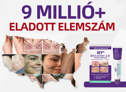 IEY® ReGenScar őssejt-heggyel kezel👨‍⚕️Keloid hegek, akne hegek, bárányhimlő hegek, műtéti hegek, égési hegek