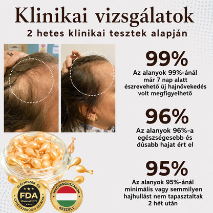 𝐋𝐞𝐠𝐧é𝐩𝐬𝐳𝐞𝐫ű𝐛𝐛 𝐭𝐞𝐫𝐦é𝐤 🎉 𝐊𝐨𝐫𝐥á𝐭𝐨𝐳𝐨𝐭𝐭 𝐢𝐝𝐞𝐣ű 𝐤𝐞𝐝𝐯𝐞𝐳𝐦é𝐧𝐲 | 👉𝐇𝐞𝐚𝐥𝐫𝐢𝐳𝐞® 𝐡𝐚𝐣𝐧ö𝐯𝐞𝐤𝐞𝐝é𝐬𝐭 𝐭á𝐦𝐨𝐠𝐚𝐭ó 𝐤𝐚𝐩𝐬𝐳𝐮𝐥𝐚 — 𝐬𝐞𝐠í𝐭 𝐭á𝐦𝐨𝐠𝐚𝐭𝐧𝐢 𝐚 𝐡𝐚𝐣𝐡𝐚𝐠𝐲𝐦á𝐤𝐚𝐭 é𝐬 𝐚 𝐝ú𝐬𝐚𝐛𝐛 𝐡𝐚𝐣 𝐦𝐞𝐠𝐣𝐞𝐥𝐞𝐧é𝐬é𝐭