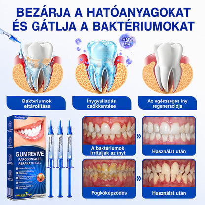 🇭🇺👨‍⚕️✅🦷 Trilumia® GumRevive – fejlett gél az íny és a fogágy ápolására