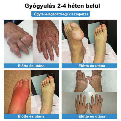 Hivatalos áruház：🌱𝐇𝐞𝐚𝐥𝐫𝐢𝐳𝐞® Nano-bevezető ízületi terápia (fájdalommentes, tartós, ízületi gyulladás, visszér és különböző ortopédiai betegségek esetén alkalmazható)