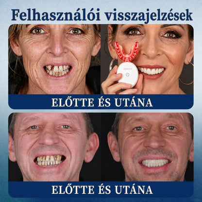 🔥 Spórolj 50%-ot Ma! 丨 REBYIPO® GumRevive – Fejlett Kettős Hullámhosszú Ínyápoló Rendszer 🦷✨