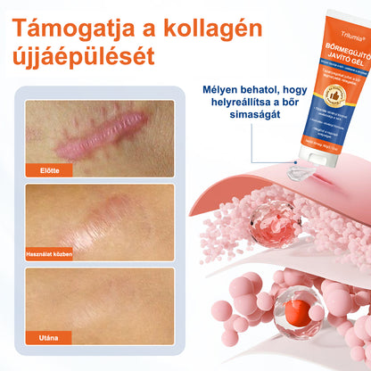 Trilumia® DermalRebuild bőrfiatalító gél👨‍⚕️Keloid hegek, akne hegek, bárányhimlő hegek, műtéti hegek, égési hegek