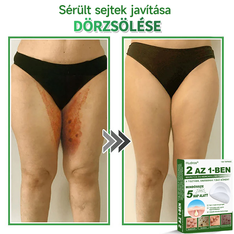 📌 𝐇𝐮𝐝𝐫𝐨𝐬® 𝟐 𝐚𝐳 𝟏-𝐛𝐞𝐧 𝐦𝐢𝐤𝐫𝐨𝐭ű𝐬 𝐡𝐢𝐝𝐫𝐨𝐤𝐨𝐥𝐥𝐨𝐢𝐝 𝐭𝐚𝐩𝐚𝐬𝐳𝐨𝐤 | 𝐊𝐢𝐞𝐦𝐞𝐥𝐤𝐞𝐝ő 𝐚𝐧𝐲𝐚𝐣𝐞𝐠𝐲𝐞𝐤, 𝐩𝐚𝐭𝐭𝐚𝐧á𝐬𝐨𝐤, 𝐥𝐚𝐩𝐨𝐬 𝐬𝐳𝐞𝐦ö𝐥𝐜𝐬ö𝐤 é𝐬 𝐛ő𝐫𝐤𝐢𝐧ö𝐯é𝐬𝐞𝐤 𝐞𝐥𝐭á𝐯𝐨𝐥í𝐭á𝐬á𝐫𝐚 𝐬𝐩𝐞𝐜𝐢𝐚𝐥𝐢𝐳á𝐥𝐯𝐚 | 𝐋á𝐭𝐡𝐚𝐭𝐚𝐭𝐥𝐚𝐧, 𝐜𝐬𝐢𝐥𝐥𝐚𝐠 𝐚𝐥𝐚𝐤ú 𝐩𝐚𝐭𝐭𝐚𝐧á𝐬𝐭𝐚𝐩𝐚𝐬𝐳𝐨𝐤 (𝐚𝐫𝐜𝐫𝐚 é𝐬 𝐭𝐞𝐬𝐭𝐫𝐞) | 𝟏𝟒𝟒 𝐝𝐚𝐫𝐚𝐛𝐨𝐬 𝐜𝐬𝐨𝐦𝐚𝐠🌱