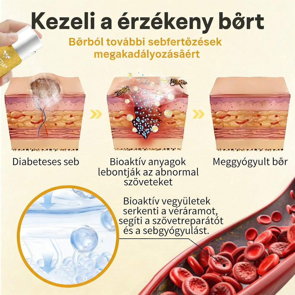 🔥Hivatalos áruház | DOCTIA® GlucoShield méhcsípés elleni sebspray
