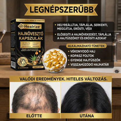 𝐋𝐞𝐠𝐧é𝐩𝐬𝐳𝐞𝐫ű𝐛𝐛 𝐭𝐞𝐫𝐦é𝐤 🎉 𝐊𝐨𝐫𝐥á𝐭𝐨𝐳𝐨𝐭𝐭 𝐢𝐝𝐞𝐣ű 𝐤𝐞𝐝𝐯𝐞𝐳𝐦é𝐧𝐲 | 👉𝐇𝐞𝐚𝐥𝐫𝐢𝐳𝐞® 𝐡𝐚𝐣𝐧ö𝐯𝐞𝐤𝐞𝐝é𝐬𝐭 𝐭á𝐦𝐨𝐠𝐚𝐭ó 𝐤𝐚𝐩𝐬𝐳𝐮𝐥𝐚 — 𝐬𝐞𝐠í𝐭 𝐭á𝐦𝐨𝐠𝐚𝐭𝐧𝐢 𝐚 𝐡𝐚𝐣𝐡𝐚𝐠𝐲𝐦á𝐤𝐚𝐭 é𝐬 𝐚 𝐝ú𝐬𝐚𝐛𝐛 𝐡𝐚𝐣 𝐦𝐞𝐠𝐣𝐞𝐥𝐞𝐧é𝐬é𝐭