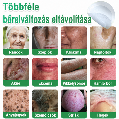 📌 𝐇𝐮𝐝𝐫𝐨𝐬® 𝟐 𝐚𝐳 𝟏-𝐛𝐞𝐧 𝐦𝐢𝐤𝐫𝐨𝐭ű𝐬 𝐡𝐢𝐝𝐫𝐨𝐤𝐨𝐥𝐥𝐨𝐢𝐝 𝐭𝐚𝐩𝐚𝐬𝐳𝐨𝐤 | 𝐊𝐢𝐞𝐦𝐞𝐥𝐤𝐞𝐝ő 𝐚𝐧𝐲𝐚𝐣𝐞𝐠𝐲𝐞𝐤, 𝐩𝐚𝐭𝐭𝐚𝐧á𝐬𝐨𝐤, 𝐥𝐚𝐩𝐨𝐬 𝐬𝐳𝐞𝐦ö𝐥𝐜𝐬ö𝐤 é𝐬 𝐛ő𝐫𝐤𝐢𝐧ö𝐯é𝐬𝐞𝐤 𝐞𝐥𝐭á𝐯𝐨𝐥í𝐭á𝐬á𝐫𝐚 𝐬𝐩𝐞𝐜𝐢𝐚𝐥𝐢𝐳á𝐥𝐯𝐚 | 𝐋á𝐭𝐡𝐚𝐭𝐚𝐭𝐥𝐚𝐧, 𝐜𝐬𝐢𝐥𝐥𝐚𝐠 𝐚𝐥𝐚𝐤ú 𝐩𝐚𝐭𝐭𝐚𝐧á𝐬𝐭𝐚𝐩𝐚𝐬𝐳𝐨𝐤 (𝐚𝐫𝐜𝐫𝐚 é𝐬 𝐭𝐞𝐬𝐭𝐫𝐞) | 𝟏𝟒𝟒 𝐝𝐚𝐫𝐚𝐛𝐨𝐬 𝐜𝐬𝐨𝐦𝐚𝐠🌱