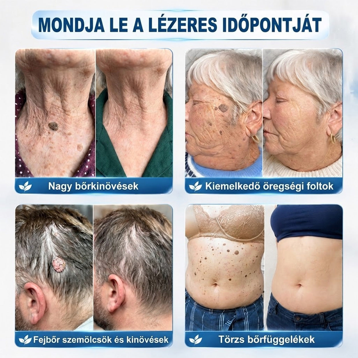 🥑🧊𝐇𝐢𝐯𝐚𝐭𝐚𝐥𝐨𝐬 𝐦á𝐫𝐤𝐚𝐛𝐨𝐥𝐭 | ✅ 𝐓𝐫𝐢𝐥𝐮𝐦𝐢𝐚® 𝟕 𝐧𝐚𝐩𝐨𝐬 𝐤é𝐬𝐳í𝐭𝐦é𝐧𝐲 𝐛ő𝐫𝐤𝐢𝐧ö𝐯=é𝐬𝐞𝐤 é𝐬 𝐩𝐢𝐠𝐦𝐞𝐧𝐭𝐟𝐨𝐥𝐭𝐨𝐤 𝐞𝐥𝐭á𝐯𝐨𝐥í𝐭á𝐬á𝐫𝐚 (𝐟á𝐣𝐝𝐚𝐥𝐨𝐦𝐦𝐞𝐧𝐭𝐞𝐬, 𝐡𝐞𝐠 𝐧é𝐥𝐤ü𝐥𝐢 𝐫𝐨𝐥𝐥-𝐨𝐧 𝐚𝐩𝐩𝐥𝐢𝐤á𝐭𝐨𝐫)