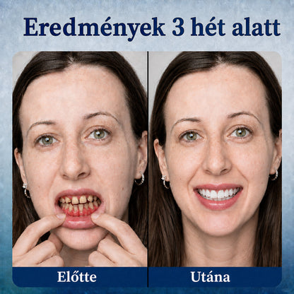 🔥 Spórolj 50%-ot Ma! 丨 REBYIPO® GumRevive – Fejlett Kettős Hullámhosszú Ínyápoló Rendszer 🦷✨