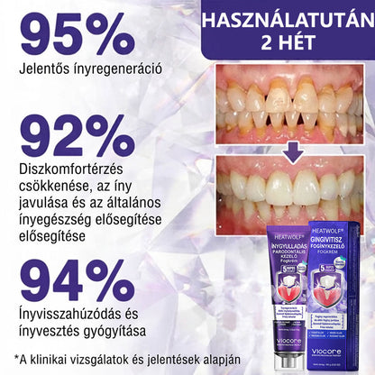 𝐇𝐄𝐀𝐓𝐖𝐎𝐋𝐅® 𝐕𝐢𝐨𝐂𝐨𝐫𝐞 𝐟𝐨𝐠𝐤𝐫é𝐦 í𝐧𝐲𝐠𝐲𝐮𝐥𝐥𝐚𝐝á𝐬 é𝐬 𝐟𝐨𝐠á𝐠𝐲𝐩𝐫𝐨𝐛𝐥é𝐦á𝐤 𝐤𝐞𝐳𝐞𝐥é𝐬é𝐫𝐞🌽