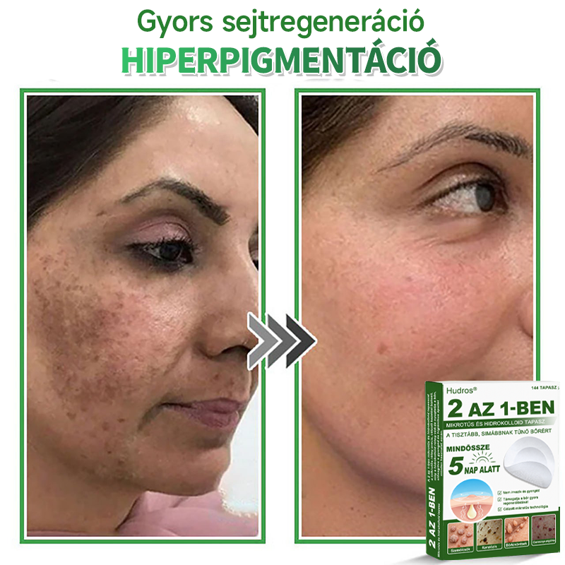 📌 𝐇𝐮𝐝𝐫𝐨𝐬® 𝟐 𝐚𝐳 𝟏-𝐛𝐞𝐧 𝐦𝐢𝐤𝐫𝐨𝐭ű𝐬 𝐡𝐢𝐝𝐫𝐨𝐤𝐨𝐥𝐥𝐨𝐢𝐝 𝐭𝐚𝐩𝐚𝐬𝐳𝐨𝐤 | 𝐊𝐢𝐞𝐦𝐞𝐥𝐤𝐞𝐝ő 𝐚𝐧𝐲𝐚𝐣𝐞𝐠𝐲𝐞𝐤, 𝐩𝐚𝐭𝐭𝐚𝐧á𝐬𝐨𝐤, 𝐥𝐚𝐩𝐨𝐬 𝐬𝐳𝐞𝐦ö𝐥𝐜𝐬ö𝐤 é𝐬 𝐛ő𝐫𝐤𝐢𝐧ö𝐯é𝐬𝐞𝐤 𝐞𝐥𝐭á𝐯𝐨𝐥í𝐭á𝐬á𝐫𝐚 𝐬𝐩𝐞𝐜𝐢𝐚𝐥𝐢𝐳á𝐥𝐯𝐚 | 𝐋á𝐭𝐡𝐚𝐭𝐚𝐭𝐥𝐚𝐧, 𝐜𝐬𝐢𝐥𝐥𝐚𝐠 𝐚𝐥𝐚𝐤ú 𝐩𝐚𝐭𝐭𝐚𝐧á𝐬𝐭𝐚𝐩𝐚𝐬𝐳𝐨𝐤 (𝐚𝐫𝐜𝐫𝐚 é𝐬 𝐭𝐞𝐬𝐭𝐫𝐞) | 𝟏𝟒𝟒 𝐝𝐚𝐫𝐚𝐛𝐨𝐬 𝐜𝐬𝐨𝐦𝐚𝐠🌱