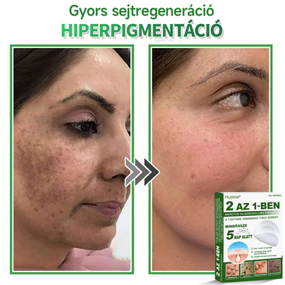 📌 𝐇𝐮𝐝𝐫𝐨𝐬® 𝟐 𝐚𝐳 𝟏-𝐛𝐞𝐧 𝐦𝐢𝐤𝐫𝐨𝐭ű𝐬 𝐡𝐢𝐝𝐫𝐨𝐤𝐨𝐥𝐥𝐨𝐢𝐝 𝐭𝐚𝐩𝐚𝐬𝐳𝐨𝐤 | 𝐊𝐢𝐞𝐦𝐞𝐥𝐤𝐞𝐝ő 𝐚𝐧𝐲𝐚𝐣𝐞𝐠𝐲𝐞𝐤, 𝐩𝐚𝐭𝐭𝐚𝐧á𝐬𝐨𝐤, 𝐥𝐚𝐩𝐨𝐬 𝐬𝐳𝐞𝐦ö𝐥𝐜𝐬ö𝐤 é𝐬 𝐛ő𝐫𝐤𝐢𝐧ö𝐯é𝐬𝐞𝐤 𝐞𝐥𝐭á𝐯𝐨𝐥í𝐭á𝐬á𝐫𝐚 𝐬𝐩𝐞𝐜𝐢𝐚𝐥𝐢𝐳á𝐥𝐯𝐚 | 𝐋á𝐭𝐡𝐚𝐭𝐚𝐭𝐥𝐚𝐧, 𝐜𝐬𝐢𝐥𝐥𝐚𝐠 𝐚𝐥𝐚𝐤ú 𝐩𝐚𝐭𝐭𝐚𝐧á𝐬𝐭𝐚𝐩𝐚𝐬𝐳𝐨𝐤 (𝐚𝐫𝐜𝐫𝐚 é𝐬 𝐭𝐞𝐬𝐭𝐫𝐞) | 𝟏𝟒𝟒 𝐝𝐚𝐫𝐚𝐛𝐨𝐬 𝐜𝐬𝐨𝐦𝐚𝐠🌱
