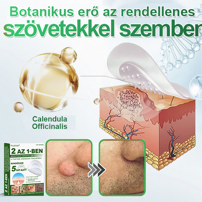 📌 𝐇𝐮𝐝𝐫𝐨𝐬® 𝟐 𝐚𝐳 𝟏-𝐛𝐞𝐧 𝐦𝐢𝐤𝐫𝐨𝐭ű𝐬 𝐡𝐢𝐝𝐫𝐨𝐤𝐨𝐥𝐥𝐨𝐢𝐝 𝐭𝐚𝐩𝐚𝐬𝐳𝐨𝐤 | 𝐊𝐢𝐞𝐦𝐞𝐥𝐤𝐞𝐝ő 𝐚𝐧𝐲𝐚𝐣𝐞𝐠𝐲𝐞𝐤, 𝐩𝐚𝐭𝐭𝐚𝐧á𝐬𝐨𝐤, 𝐥𝐚𝐩𝐨𝐬 𝐬𝐳𝐞𝐦ö𝐥𝐜𝐬ö𝐤 é𝐬 𝐛ő𝐫𝐤𝐢𝐧ö𝐯é𝐬𝐞𝐤 𝐞𝐥𝐭á𝐯𝐨𝐥í𝐭á𝐬á𝐫𝐚 𝐬𝐩𝐞𝐜𝐢𝐚𝐥𝐢𝐳á𝐥𝐯𝐚 | 𝐋á𝐭𝐡𝐚𝐭𝐚𝐭𝐥𝐚𝐧, 𝐜𝐬𝐢𝐥𝐥𝐚𝐠 𝐚𝐥𝐚𝐤ú 𝐩𝐚𝐭𝐭𝐚𝐧á𝐬𝐭𝐚𝐩𝐚𝐬𝐳𝐨𝐤 (𝐚𝐫𝐜𝐫𝐚 é𝐬 𝐭𝐞𝐬𝐭𝐫𝐞) | 𝟏𝟒𝟒 𝐝𝐚𝐫𝐚𝐛𝐨𝐬 𝐜𝐬𝐨𝐦𝐚𝐠🌱