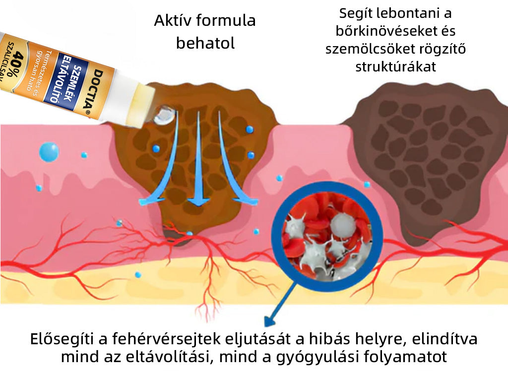 🏆 Magyarország legkelendőbb terméke | 🛡️ 48 órás fájdalommentes bőrtisztítás DOCTIA® szilárd szivacsos szemölcseltávolító
