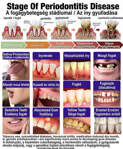 𝐇𝐄𝐀𝐓𝐖𝐎𝐋𝐅® 𝐕𝐢𝐨𝐂𝐨𝐫𝐞 𝐟𝐨𝐠𝐤𝐫é𝐦 í𝐧𝐲𝐠𝐲𝐮𝐥𝐥𝐚𝐝á𝐬 é𝐬 𝐟𝐨𝐠á𝐠𝐲𝐩𝐫𝐨𝐛𝐥é𝐦á𝐤 𝐤𝐞𝐳𝐞𝐥é𝐬é𝐫𝐞🌽