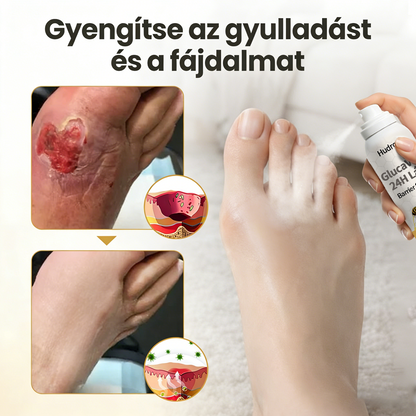 Hudros® 🌱GlucaVeil 24H lábvédő spray