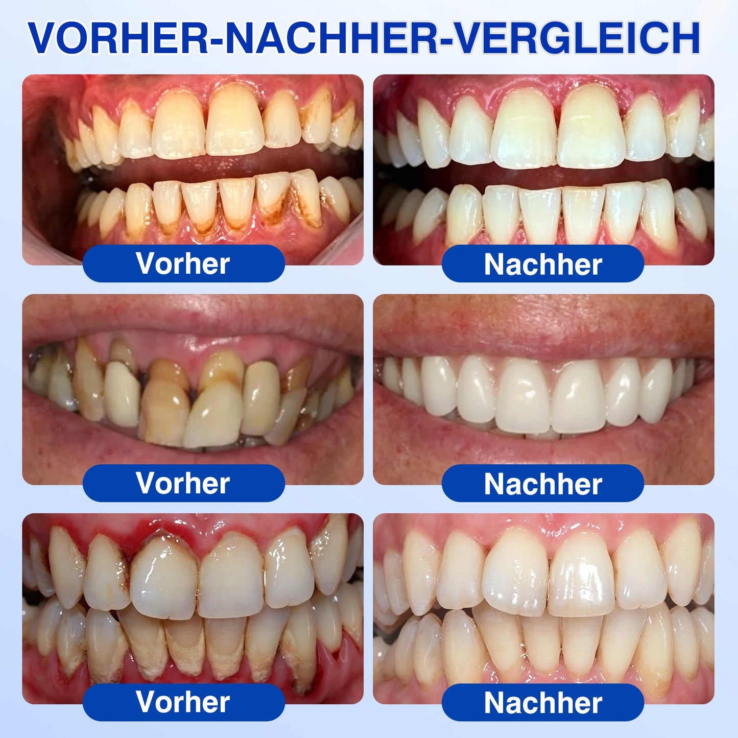🇭🇺👨‍⚕️✅🦷 Trilumia® GumRevive – fejlett gél az íny és a fogágy ápolására