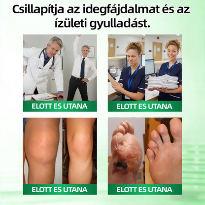[Újévi különleges ajánlat] CureVivo® fájdalomcsillapító és regeneráló krém🦄Izom-, ízületi és idegfájdalmakra