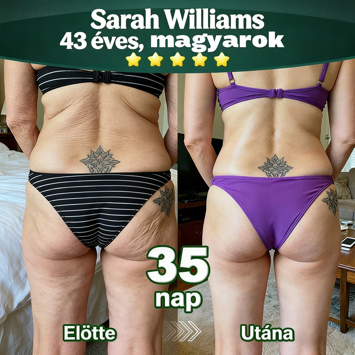 𝐇𝐢𝐯𝐚𝐭𝐚𝐥𝐨𝐬𝐚𝐧 𝐞𝐧𝐠𝐞𝐝é𝐥𝐲𝐞𝐳𝐞𝐭𝐭 𝐞𝐱𝐤𝐥𝐮𝐳í𝐯 𝐤𝐢𝐚𝐝á𝐬 ✅👩‍⚕️ 𝐃𝐎𝐂𝐓𝐈𝐀® 𝐊𝐥𝐨𝐫𝐨𝐟𝐢𝐥𝐥 & Ő𝐬𝐬𝐞𝐣𝐭 𝐓𝐞𝐬𝐭𝐦𝐞𝐠ú𝐣í𝐭ó 𝐒𝐳é𝐫𝐮𝐦 (𝐌𝐞𝐠𝐞𝐦𝐞𝐥𝐢 é𝐬 𝐟𝐞𝐬𝐳𝐞𝐬í𝐭𝐢 𝐚 𝐦𝐞𝐠𝐞𝐫𝐞𝐬𝐳𝐤𝐞𝐝𝐞𝐭𝐭 𝐛ő𝐫𝐭, 𝐯𝐚𝐥𝐚𝐦𝐢𝐧𝐭 𝐜𝐬ö𝐤𝐤𝐞𝐧𝐭𝐢 𝐚 𝐫á𝐧𝐜𝐨𝐤 𝐤𝐢𝐚𝐥𝐚𝐤𝐮𝐥á𝐬á𝐭) 🍅🍅