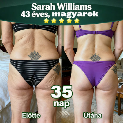 𝐇𝐢𝐯𝐚𝐭𝐚𝐥𝐨𝐬𝐚𝐧 𝐞𝐧𝐠𝐞𝐝é𝐥𝐲𝐞𝐳𝐞𝐭𝐭 𝐞𝐱𝐤𝐥𝐮𝐳í𝐯 𝐤𝐢𝐚𝐝á𝐬 ✅👩‍⚕️ 𝐃𝐎𝐂𝐓𝐈𝐀® 𝐊𝐥𝐨𝐫𝐨𝐟𝐢𝐥𝐥 & Ő𝐬𝐬𝐞𝐣𝐭 𝐓𝐞𝐬𝐭𝐦𝐞𝐠ú𝐣í𝐭ó 𝐒𝐳é𝐫𝐮𝐦 (𝐌𝐞𝐠𝐞𝐦𝐞𝐥𝐢 é𝐬 𝐟𝐞𝐬𝐳𝐞𝐬í𝐭𝐢 𝐚 𝐦𝐞𝐠𝐞𝐫𝐞𝐬𝐳𝐤𝐞𝐝𝐞𝐭𝐭 𝐛ő𝐫𝐭, 𝐯𝐚𝐥𝐚𝐦𝐢𝐧𝐭 𝐜𝐬ö𝐤𝐤𝐞𝐧𝐭𝐢 𝐚 𝐫á𝐧𝐜𝐨𝐤 𝐤𝐢𝐚𝐥𝐚𝐤𝐮𝐥á𝐬á𝐭) 🍅🍅