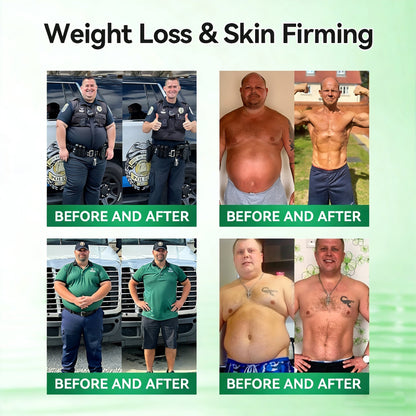 𝐏𝐡𝐲𝐬𝐢𝐜𝐢𝐚𝐧-𝐅𝐨𝐫𝐦𝐮𝐥𝐚𝐭𝐞𝐝🌱 | 𝐌𝐑𝐄𝐕𝐁𝑺𝑰𝑵® 𝐁𝐞𝐫𝐛𝐞𝐫𝐢𝐧𝐞 × 𝐍𝐀𝐃+ 𝟏𝟎-𝐢𝐧-𝟏 𝐀𝐝𝐯𝐚𝐧𝐜𝐞𝐝 𝐓𝐡𝐞𝐫𝐦𝐨-𝐀𝐜𝐭𝐢𝐯𝐞 𝐁𝐨𝐝𝐲 𝐂𝐨𝐧𝐭𝐨𝐮𝐫 𝐒𝐥𝐢𝐦𝐦𝐢𝐧𝐠 𝐒𝐭𝐢𝐜𝐤 (𝐅𝐨𝐫 𝐚 𝐅𝐢𝐫𝐦𝐞𝐫, 𝐒𝐦𝐨𝐨𝐭𝐡𝐞𝐫 & 𝐌𝐨𝐫𝐞 𝐃𝐞𝐟𝐢𝐧𝐞𝐝-𝐋𝐨𝐨𝐤𝐢𝐧𝐠 𝐁𝐨𝐝𝐲)
