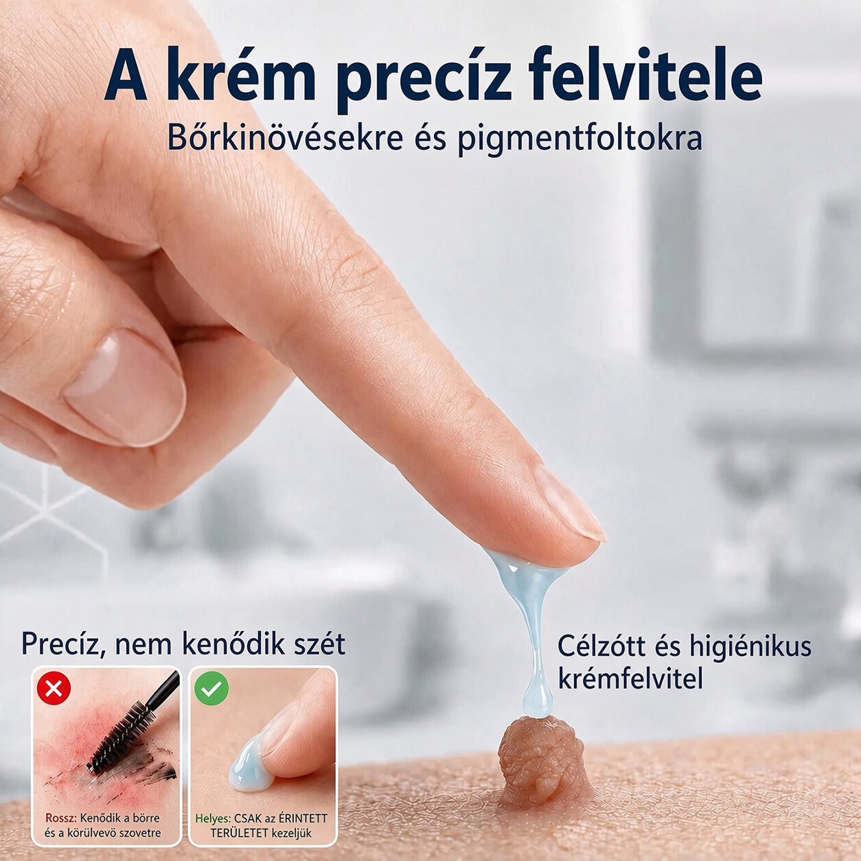 🏅 70% KEDVEZMÉNY | CUREVIVO® HIVATALOS ÜZLET | 7 napos célzott bőrkinövés- és foltápoló krém – GMP-minősített gyártás