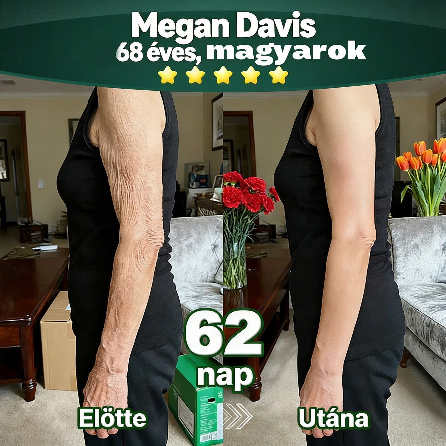 𝐇𝐢𝐯𝐚𝐭𝐚𝐥𝐨𝐬𝐚𝐧 𝐞𝐧𝐠𝐞𝐝é𝐥𝐲𝐞𝐳𝐞𝐭𝐭 𝐞𝐱𝐤𝐥𝐮𝐳í𝐯 𝐤𝐢𝐚𝐝á𝐬 ✅👩‍⚕️ 𝐃𝐎𝐂𝐓𝐈𝐀® 𝐊𝐥𝐨𝐫𝐨𝐟𝐢𝐥𝐥 & Ő𝐬𝐬𝐞𝐣𝐭 𝐓𝐞𝐬𝐭𝐦𝐞𝐠ú𝐣í𝐭ó 𝐒𝐳é𝐫𝐮𝐦 (𝐌𝐞𝐠𝐞𝐦𝐞𝐥𝐢 é𝐬 𝐟𝐞𝐬𝐳𝐞𝐬í𝐭𝐢 𝐚 𝐦𝐞𝐠𝐞𝐫𝐞𝐬𝐳𝐤𝐞𝐝𝐞𝐭𝐭 𝐛ő𝐫𝐭, 𝐯𝐚𝐥𝐚𝐦𝐢𝐧𝐭 𝐜𝐬ö𝐤𝐤𝐞𝐧𝐭𝐢 𝐚 𝐫á𝐧𝐜𝐨𝐤 𝐤𝐢𝐚𝐥𝐚𝐤𝐮𝐥á𝐬á𝐭) 🍅🍅