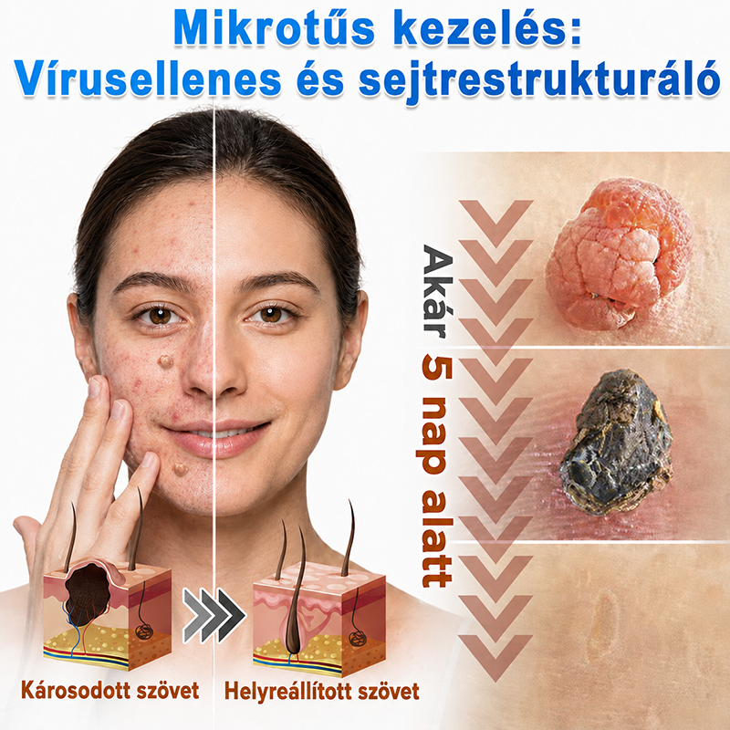 📌 𝐇𝐮𝐝𝐫𝐨𝐬® 𝟐 𝐚𝐳 𝟏-𝐛𝐞𝐧 𝐦𝐢𝐤𝐫𝐨𝐭ű𝐬 𝐡𝐢𝐝𝐫𝐨𝐤𝐨𝐥𝐥𝐨𝐢𝐝 𝐭𝐚𝐩𝐚𝐬𝐳𝐨𝐤 | 𝐊𝐢𝐞𝐦𝐞𝐥𝐤𝐞𝐝ő 𝐚𝐧𝐲𝐚𝐣𝐞𝐠𝐲𝐞𝐤, 𝐩𝐚𝐭𝐭𝐚𝐧á𝐬𝐨𝐤, 𝐥𝐚𝐩𝐨𝐬 𝐬𝐳𝐞𝐦ö𝐥𝐜𝐬ö𝐤 é𝐬 𝐛ő𝐫𝐤𝐢𝐧ö𝐯é𝐬𝐞𝐤 𝐞𝐥𝐭á𝐯𝐨𝐥í𝐭á𝐬á𝐫𝐚 𝐬𝐩𝐞𝐜𝐢𝐚𝐥𝐢𝐳á𝐥𝐯𝐚 | 𝐋á𝐭𝐡𝐚𝐭𝐚𝐭𝐥𝐚𝐧, 𝐜𝐬𝐢𝐥𝐥𝐚𝐠 𝐚𝐥𝐚𝐤ú 𝐩𝐚𝐭𝐭𝐚𝐧á𝐬𝐭𝐚𝐩𝐚𝐬𝐳𝐨𝐤 (𝐚𝐫𝐜𝐫𝐚 é𝐬 𝐭𝐞𝐬𝐭𝐫𝐞) | 𝟏𝟒𝟒 𝐝𝐚𝐫𝐚𝐛𝐨𝐬 𝐜𝐬𝐨𝐦𝐚𝐠🌱