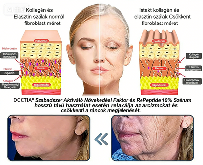 DOCTIA® Ő𝙨𝙨𝙚𝙟𝙩 𝙆𝙞𝙫𝙤𝙣𝙖𝙩 𝙀𝙂𝙁 é𝙨 𝙍é𝙯 𝙋𝙚𝙥𝙩𝙞𝙙 𝙍𝙚𝙫𝙞𝙩𝙖𝙡𝙞𝙯á𝙡ó 𝙀𝙨𝙨𝙯𝙚𝙣𝙘𝙞𝙖 𝙆𝙧é𝙢 (𝙢é𝙡𝙮𝙚𝙣 𝙖𝙠𝙩𝙞𝙫á𝙡𝙟𝙖 𝙖 𝙗ő𝙧 𝙗𝙚𝙡𝙨ő 𝙧𝙚𝙜𝙚𝙣𝙚𝙧á𝙘𝙞ó𝙟á𝙩, 𝙛𝙚𝙨𝙯𝙚𝙨𝙚𝙗𝙗é é𝙨 𝙨𝙞𝙢á𝙗𝙗á 𝙩𝙚𝙨𝙯𝙞 𝙖 𝙗ő𝙧𝙩) 🍈