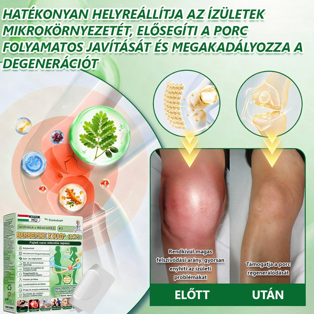 𝐇𝐢𝐯𝐚𝐭𝐚𝐥𝐨𝐬 𝐀𝐦𝐞𝐫𝐢𝐤𝐚𝐢 𝐁𝐨𝐥𝐭  🇭🇺| 𝑪𝒖𝒓𝒆𝑽𝒊𝒗𝒐® 💎 𝑴𝒐𝒓𝒊𝒏𝒈𝒂 × 𝑴𝒆́𝒉𝒎𝒆́𝒓𝒆𝒈 · 𝑩𝒆𝒓𝒃𝒆𝒓𝒊𝒏 × 𝑵𝑨𝑫+ 𝟏𝟎-𝐚𝐳-𝟏-𝐛𝐞𝐧 𝐅𝐞𝐣𝐥𝐞𝐭𝐭 𝐍𝐚𝐧𝐨 𝐌𝐢𝐤𝐫𝐨𝐭𝐮̋𝐬 𝐓𝐚𝐩𝐚𝐬𝐳 — 𝐍𝐚𝐩𝐢 𝐄𝐠𝐲𝐬𝐳𝐞𝐫, 𝐋𝐚́𝐭𝐡𝐚𝐭𝐨́ 𝐄𝐫𝐞𝐝𝐦𝐞́𝐧𝐲𝐞𝐤 𝟕 𝐍𝐚𝐩𝐨𝐧 𝐁𝐞𝐥𝐮̈𝐥