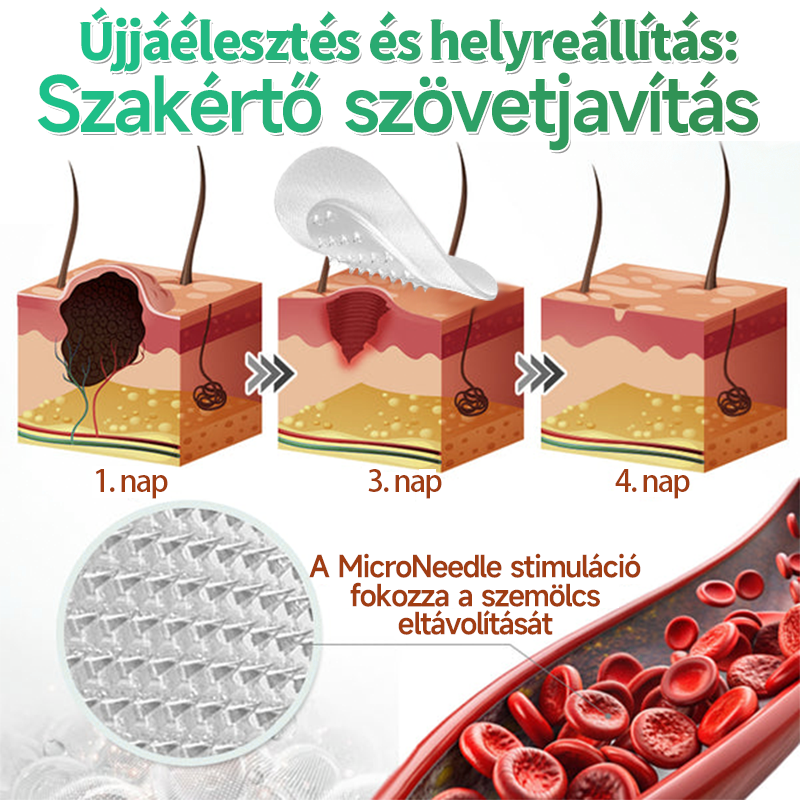 📌 𝐇𝐮𝐝𝐫𝐨𝐬® 𝟐 𝐚𝐳 𝟏-𝐛𝐞𝐧 𝐦𝐢𝐤𝐫𝐨𝐭ű𝐬 𝐡𝐢𝐝𝐫𝐨𝐤𝐨𝐥𝐥𝐨𝐢𝐝 𝐭𝐚𝐩𝐚𝐬𝐳𝐨𝐤 | 𝐊𝐢𝐞𝐦𝐞𝐥𝐤𝐞𝐝ő 𝐚𝐧𝐲𝐚𝐣𝐞𝐠𝐲𝐞𝐤, 𝐩𝐚𝐭𝐭𝐚𝐧á𝐬𝐨𝐤, 𝐥𝐚𝐩𝐨𝐬 𝐬𝐳𝐞𝐦ö𝐥𝐜𝐬ö𝐤 é𝐬 𝐛ő𝐫𝐤𝐢𝐧ö𝐯é𝐬𝐞𝐤 𝐞𝐥𝐭á𝐯𝐨𝐥í𝐭á𝐬á𝐫𝐚 𝐬𝐩𝐞𝐜𝐢𝐚𝐥𝐢𝐳á𝐥𝐯𝐚 | 𝐋á𝐭𝐡𝐚𝐭𝐚𝐭𝐥𝐚𝐧, 𝐜𝐬𝐢𝐥𝐥𝐚𝐠 𝐚𝐥𝐚𝐤ú 𝐩𝐚𝐭𝐭𝐚𝐧á𝐬𝐭𝐚𝐩𝐚𝐬𝐳𝐨𝐤 (𝐚𝐫𝐜𝐫𝐚 é𝐬 𝐭𝐞𝐬𝐭𝐫𝐞) | 𝟏𝟒𝟒 𝐝𝐚𝐫𝐚𝐛𝐨𝐬 𝐜𝐬𝐨𝐦𝐚𝐠🌱