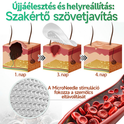 📌 𝐇𝐮𝐝𝐫𝐨𝐬® 𝟐 𝐚𝐳 𝟏-𝐛𝐞𝐧 𝐦𝐢𝐤𝐫𝐨𝐭ű𝐬 𝐡𝐢𝐝𝐫𝐨𝐤𝐨𝐥𝐥𝐨𝐢𝐝 𝐭𝐚𝐩𝐚𝐬𝐳𝐨𝐤 | 𝐊𝐢𝐞𝐦𝐞𝐥𝐤𝐞𝐝ő 𝐚𝐧𝐲𝐚𝐣𝐞𝐠𝐲𝐞𝐤, 𝐩𝐚𝐭𝐭𝐚𝐧á𝐬𝐨𝐤, 𝐥𝐚𝐩𝐨𝐬 𝐬𝐳𝐞𝐦ö𝐥𝐜𝐬ö𝐤 é𝐬 𝐛ő𝐫𝐤𝐢𝐧ö𝐯é𝐬𝐞𝐤 𝐞𝐥𝐭á𝐯𝐨𝐥í𝐭á𝐬á𝐫𝐚 𝐬𝐩𝐞𝐜𝐢𝐚𝐥𝐢𝐳á𝐥𝐯𝐚 | 𝐋á𝐭𝐡𝐚𝐭𝐚𝐭𝐥𝐚𝐧, 𝐜𝐬𝐢𝐥𝐥𝐚𝐠 𝐚𝐥𝐚𝐤ú 𝐩𝐚𝐭𝐭𝐚𝐧á𝐬𝐭𝐚𝐩𝐚𝐬𝐳𝐨𝐤 (𝐚𝐫𝐜𝐫𝐚 é𝐬 𝐭𝐞𝐬𝐭𝐫𝐞) | 𝟏𝟒𝟒 𝐝𝐚𝐫𝐚𝐛𝐨𝐬 𝐜𝐬𝐨𝐦𝐚𝐠🌱