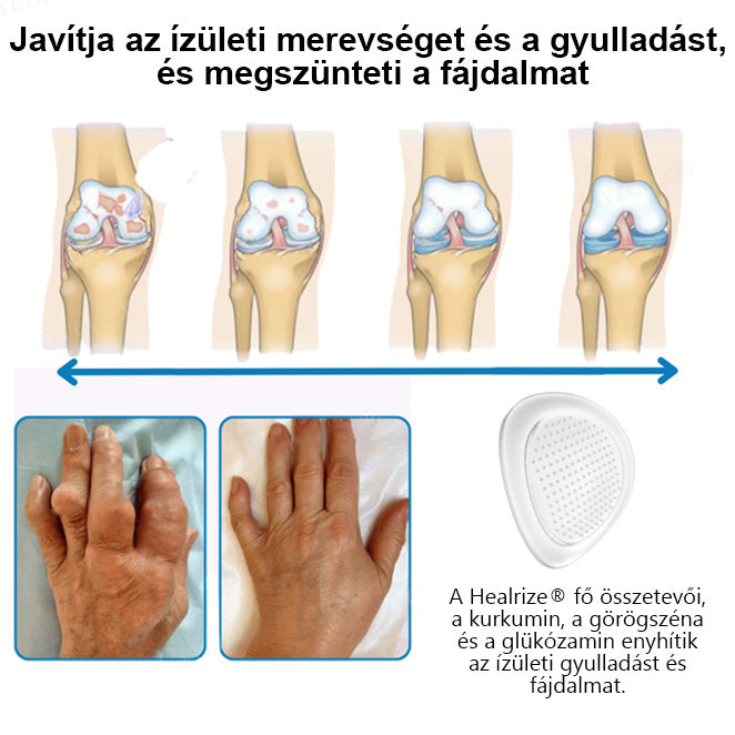 Hivatalos áruház：🌱𝐇𝐞𝐚𝐥𝐫𝐢𝐳𝐞® Nano-bevezető ízületi terápia (fájdalommentes, tartós, ízületi gyulladás, visszér és különböző ortopédiai betegségek esetén alkalmazható)