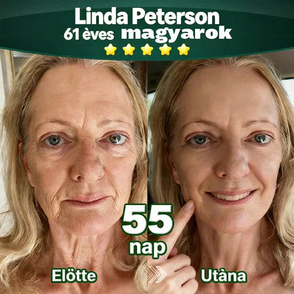 𝐇𝐢𝐯𝐚𝐭𝐚𝐥𝐨𝐬𝐚𝐧 𝐞𝐧𝐠𝐞𝐝é𝐥𝐲𝐞𝐳𝐞𝐭𝐭 𝐞𝐱𝐤𝐥𝐮𝐳í𝐯 𝐤𝐢𝐚𝐝á𝐬 ✅👩‍⚕️ 𝐃𝐎𝐂𝐓𝐈𝐀® 𝐊𝐥𝐨𝐫𝐨𝐟𝐢𝐥𝐥 & Ő𝐬𝐬𝐞𝐣𝐭 𝐓𝐞𝐬𝐭𝐦𝐞𝐠ú𝐣í𝐭ó 𝐒𝐳é𝐫𝐮𝐦 (𝐌𝐞𝐠𝐞𝐦𝐞𝐥𝐢 é𝐬 𝐟𝐞𝐬𝐳𝐞𝐬í𝐭𝐢 𝐚 𝐦𝐞𝐠𝐞𝐫𝐞𝐬𝐳𝐤𝐞𝐝𝐞𝐭𝐭 𝐛ő𝐫𝐭, 𝐯𝐚𝐥𝐚𝐦𝐢𝐧𝐭 𝐜𝐬ö𝐤𝐤𝐞𝐧𝐭𝐢 𝐚 𝐫á𝐧𝐜𝐨𝐤 𝐤𝐢𝐚𝐥𝐚𝐤𝐮𝐥á𝐬á𝐭) 🍅🍅