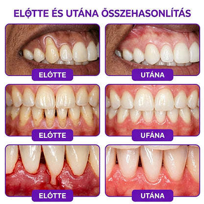 𝐇𝐄𝐀𝐓𝐖𝐎𝐋𝐅® 𝐕𝐢𝐨𝐂𝐨𝐫𝐞 𝐟𝐨𝐠𝐤𝐫é𝐦 í𝐧𝐲𝐠𝐲𝐮𝐥𝐥𝐚𝐝á𝐬 é𝐬 𝐟𝐨𝐠á𝐠𝐲𝐩𝐫𝐨𝐛𝐥é𝐦á𝐤 𝐤𝐞𝐳𝐞𝐥é𝐬é𝐫𝐞🌽