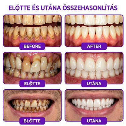 𝐇𝐄𝐀𝐓𝐖𝐎𝐋𝐅® 𝐕𝐢𝐨𝐂𝐨𝐫𝐞 𝐟𝐨𝐠𝐤𝐫é𝐦 í𝐧𝐲𝐠𝐲𝐮𝐥𝐥𝐚𝐝á𝐬 é𝐬 𝐟𝐨𝐠á𝐠𝐲𝐩𝐫𝐨𝐛𝐥é𝐦á𝐤 𝐤𝐞𝐳𝐞𝐥é𝐬é𝐫𝐞🌽