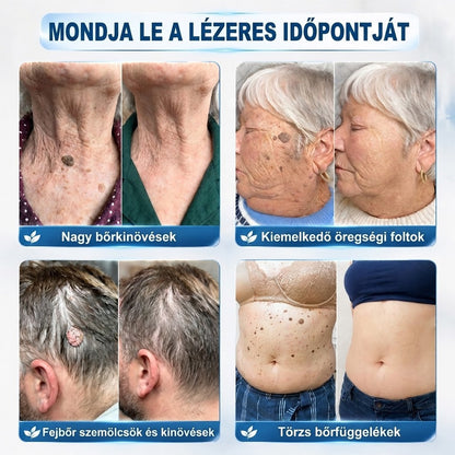 🏅 70% KEDVEZMÉNY | CUREVIVO® HIVATALOS ÜZLET | 7 napos célzott bőrkinövés- és foltápoló krém – GMP-minősített gyártás