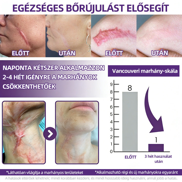 IEY® ReGenScar őssejt-heggyel kezel👨‍⚕️Keloid hegek, akne hegek, bárányhimlő hegek, műtéti hegek, égési hegek