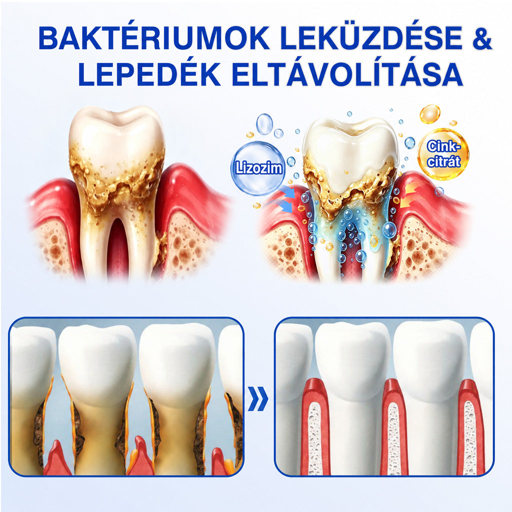 🇭🇺👨‍⚕️✅🦷 Trilumia® GumRevive – fejlett gél az íny és a fogágy ápolására