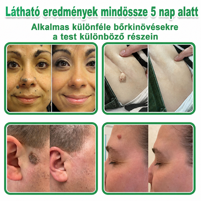 📌 𝐇𝐮𝐝𝐫𝐨𝐬® 𝟐 𝐚𝐳 𝟏-𝐛𝐞𝐧 𝐦𝐢𝐤𝐫𝐨𝐭ű𝐬 𝐡𝐢𝐝𝐫𝐨𝐤𝐨𝐥𝐥𝐨𝐢𝐝 𝐭𝐚𝐩𝐚𝐬𝐳𝐨𝐤 | 𝐊𝐢𝐞𝐦𝐞𝐥𝐤𝐞𝐝ő 𝐚𝐧𝐲𝐚𝐣𝐞𝐠𝐲𝐞𝐤, 𝐩𝐚𝐭𝐭𝐚𝐧á𝐬𝐨𝐤, 𝐥𝐚𝐩𝐨𝐬 𝐬𝐳𝐞𝐦ö𝐥𝐜𝐬ö𝐤 é𝐬 𝐛ő𝐫𝐤𝐢𝐧ö𝐯é𝐬𝐞𝐤 𝐞𝐥𝐭á𝐯𝐨𝐥í𝐭á𝐬á𝐫𝐚 𝐬𝐩𝐞𝐜𝐢𝐚𝐥𝐢𝐳á𝐥𝐯𝐚 | 𝐋á𝐭𝐡𝐚𝐭𝐚𝐭𝐥𝐚𝐧, 𝐜𝐬𝐢𝐥𝐥𝐚𝐠 𝐚𝐥𝐚𝐤ú 𝐩𝐚𝐭𝐭𝐚𝐧á𝐬𝐭𝐚𝐩𝐚𝐬𝐳𝐨𝐤 (𝐚𝐫𝐜𝐫𝐚 é𝐬 𝐭𝐞𝐬𝐭𝐫𝐞) | 𝟏𝟒𝟒 𝐝𝐚𝐫𝐚𝐛𝐨𝐬 𝐜𝐬𝐨𝐦𝐚𝐠🌱
