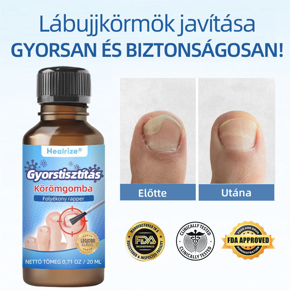 𝑯𝒆𝒂𝒍𝒓𝒊𝒛𝒆® 𝑵𝒂𝒏𝒐 𝑮𝒚𝒐𝒓𝒔 𝑯𝒂𝒕á𝒔ú 𝑻𝒊𝒔𝒛𝒕í𝒕ó 𝑲ö𝒓ö𝒎𝒈𝒐𝒎𝒃𝒂 𝑬𝒍𝒍𝒆𝒏𝒊 𝑱𝒂𝒗í𝒕ó 𝑭𝒐𝒍𝒚𝒂𝒅é𝒌 🧑‍⚕️ | 𝑯𝒂𝒕é𝒌𝒐𝒏𝒚 7 𝒏𝒂𝒑 𝒂𝒍𝒂𝒕𝒕, 𝒕𝒂𝒓𝒕ó𝒔𝒂𝒏 𝒎𝒆𝒈𝒔𝒛ü𝒏𝒕𝒆𝒕𝒊 𝒂 𝒌𝒊𝒗á𝒍𝒕ó 𝒐𝒌𝒐𝒕 🥥