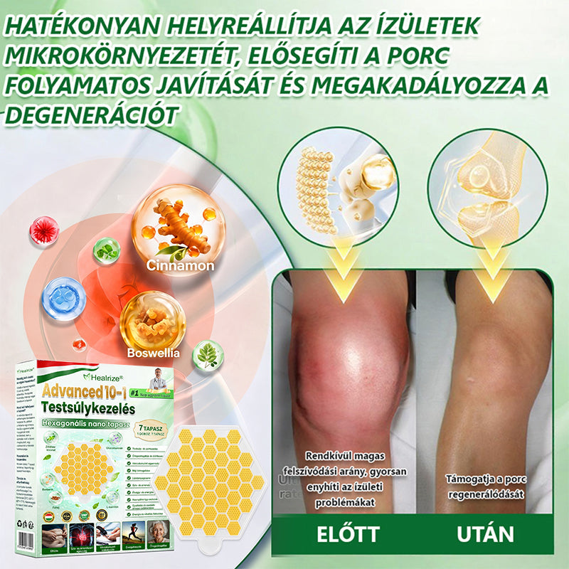 💎💎💎 𝐇𝐢𝐯𝐚𝐭𝐚𝐥𝐨𝐬 ü𝐳𝐥𝐞𝐭 | 𝐇𝐞𝐚𝐥𝐫𝐢𝐳𝐞® 𝐅𝐞𝐣𝐥𝐞𝐭𝐭 𝐡𝐚𝐭𝐬𝐳ö𝐠𝐥𝐞𝐭ű 𝐧𝐚𝐧𝐨 𝐬ú𝐥𝐲𝐤𝐨𝐧𝐭𝐫𝐨𝐥𝐥 𝐭𝐚𝐩𝐚𝐬𝐳