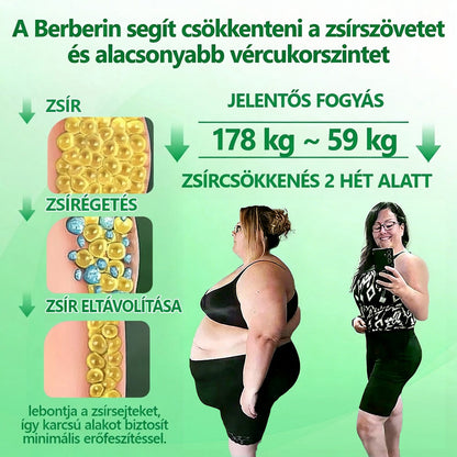 𝐇𝐢𝐯𝐚𝐭𝐚𝐥𝐨𝐬 á𝐫𝐮𝐡á𝐳 | ✅️ 𝐃𝐎𝐂𝐓𝐈𝐀® 𝐌𝐞𝐭𝐚𝐛𝐨𝐥𝐢𝐤𝐮𝐬 𝐜𝐢𝐤𝐥𝐮𝐬 𝐬𝐳é𝐫𝐮𝐦: 𝐅𝐞𝐥𝐠𝐲𝐨𝐫𝐬í𝐭𝐣𝐚 𝐚𝐳 𝐚𝐧𝐲𝐚𝐠𝐜𝐬𝐞𝐫é𝐭, 𝐜𝐬ö𝐤𝐤𝐞𝐧𝐭𝐢 𝐚𝐳 é𝐭𝐯á𝐠𝐲𝐚𝐭, 𝐟𝐞𝐬𝐳𝐞𝐬í𝐭𝐢 𝐚 𝐛ő𝐫𝐭, 𝐞𝐫ő𝐭𝐞𝐥𝐣𝐞𝐬 𝐳𝐬í𝐫é𝐠𝐞𝐭é𝐬 🥑🥑