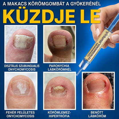 🇭🇺 𝐓𝐫𝐢𝐥𝐮𝐦𝐢𝐚® 𝐅𝐮𝐧𝐠𝐢 𝐅𝐫𝐞𝐞 𝐦é𝐡𝐦é𝐫𝐠𝐞𝐬 𝐤ö𝐫ö𝐦𝐤𝐞𝐳𝐞𝐥é𝐬 🥼 – 𝐡é𝐭 𝐧𝐚𝐩𝐨𝐧 𝐛𝐞𝐥ü𝐥 𝐚𝐳𝐨𝐧𝐧𝐚𝐥𝐢 𝐥á𝐭𝐡𝐚𝐭ó 𝐞𝐫𝐞𝐝𝐦é𝐧𝐲é𝐫𝐭