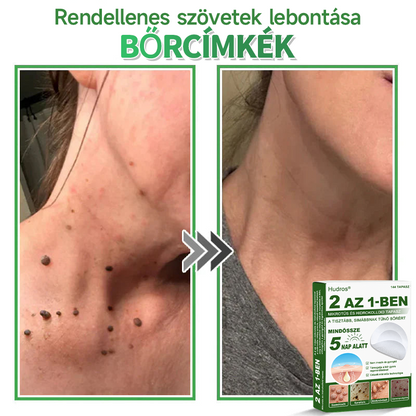 📌 𝐇𝐮𝐝𝐫𝐨𝐬® 𝟐 𝐚𝐳 𝟏-𝐛𝐞𝐧 𝐦𝐢𝐤𝐫𝐨𝐭ű𝐬 𝐡𝐢𝐝𝐫𝐨𝐤𝐨𝐥𝐥𝐨𝐢𝐝 𝐭𝐚𝐩𝐚𝐬𝐳𝐨𝐤 | 𝐊𝐢𝐞𝐦𝐞𝐥𝐤𝐞𝐝ő 𝐚𝐧𝐲𝐚𝐣𝐞𝐠𝐲𝐞𝐤, 𝐩𝐚𝐭𝐭𝐚𝐧á𝐬𝐨𝐤, 𝐥𝐚𝐩𝐨𝐬 𝐬𝐳𝐞𝐦ö𝐥𝐜𝐬ö𝐤 é𝐬 𝐛ő𝐫𝐤𝐢𝐧ö𝐯é𝐬𝐞𝐤 𝐞𝐥𝐭á𝐯𝐨𝐥í𝐭á𝐬á𝐫𝐚 𝐬𝐩𝐞𝐜𝐢𝐚𝐥𝐢𝐳á𝐥𝐯𝐚 | 𝐋á𝐭𝐡𝐚𝐭𝐚𝐭𝐥𝐚𝐧, 𝐜𝐬𝐢𝐥𝐥𝐚𝐠 𝐚𝐥𝐚𝐤ú 𝐩𝐚𝐭𝐭𝐚𝐧á𝐬𝐭𝐚𝐩𝐚𝐬𝐳𝐨𝐤 (𝐚𝐫𝐜𝐫𝐚 é𝐬 𝐭𝐞𝐬𝐭𝐫𝐞) | 𝟏𝟒𝟒 𝐝𝐚𝐫𝐚𝐛𝐨𝐬 𝐜𝐬𝐨𝐦𝐚𝐠🌱