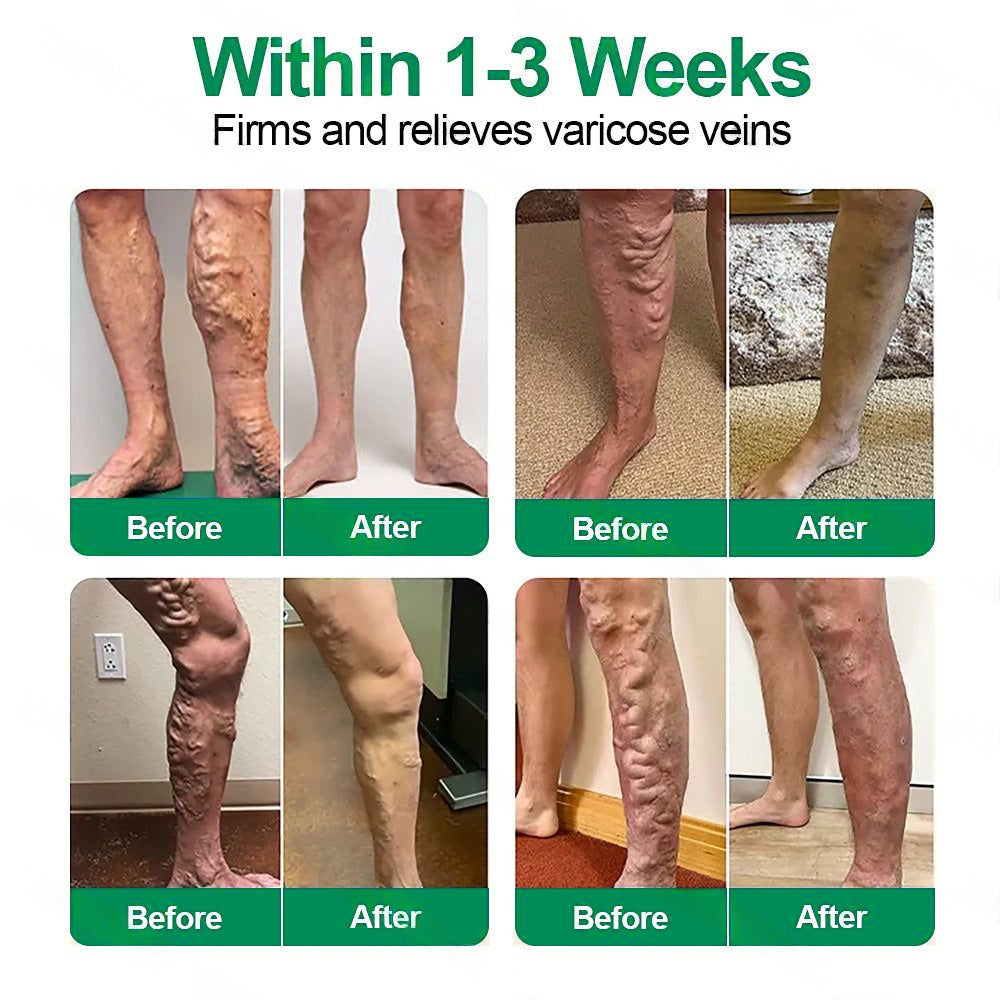 Healrize® 🛒VeinTarget mikrotűs tapasz ⚡Azonnali enyhülés hosszú távú eredmények
